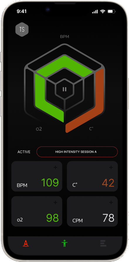 RadarPro — Monitor